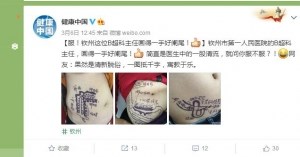 我院B超专家林建军成“网红”