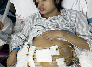 一名重症坏死性胰腺炎妈妈的“重生”之路……